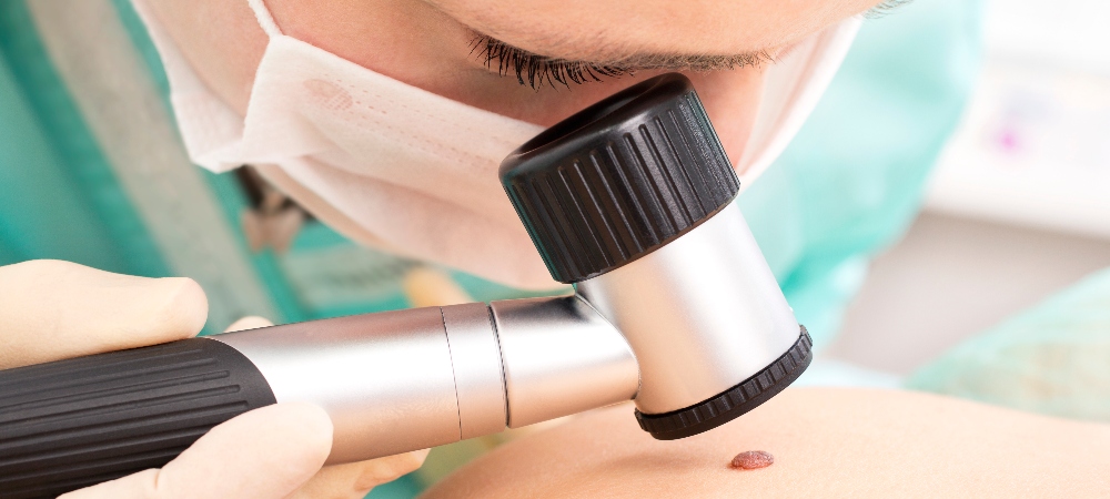 medical worker analyzing skin mole