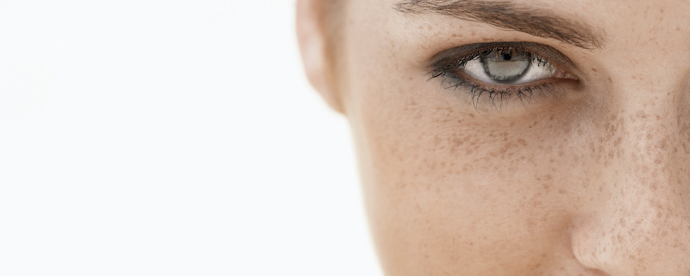 Young woman with freckles