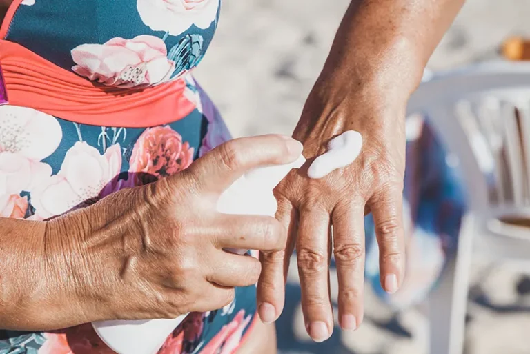 Close-up of a person applying sunscreen to the back of their hand while wearing a floral swimsuit at the beach.