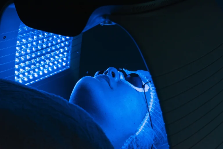 Patient undergoing blue light therapy (photodynamic therapy) for skin treatment, lying under a specialized lamp with protective eyewear.