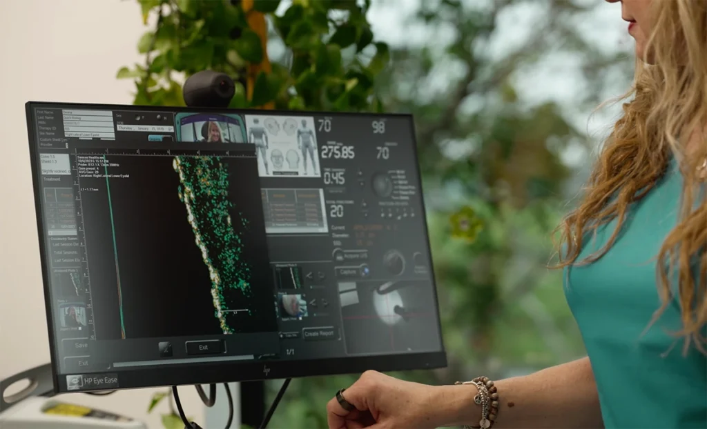 Close up of a clinical monitor displaying detailed skin imaging and diagnostic data during a GentleCure evaluation, with a clinician reviewing the scan results in a medical office setting.